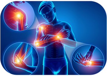 MSDs, the leading cause of disability in the manufacturing industry. MSDs in figures.